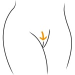 Brazilian Waxing Pfeil
